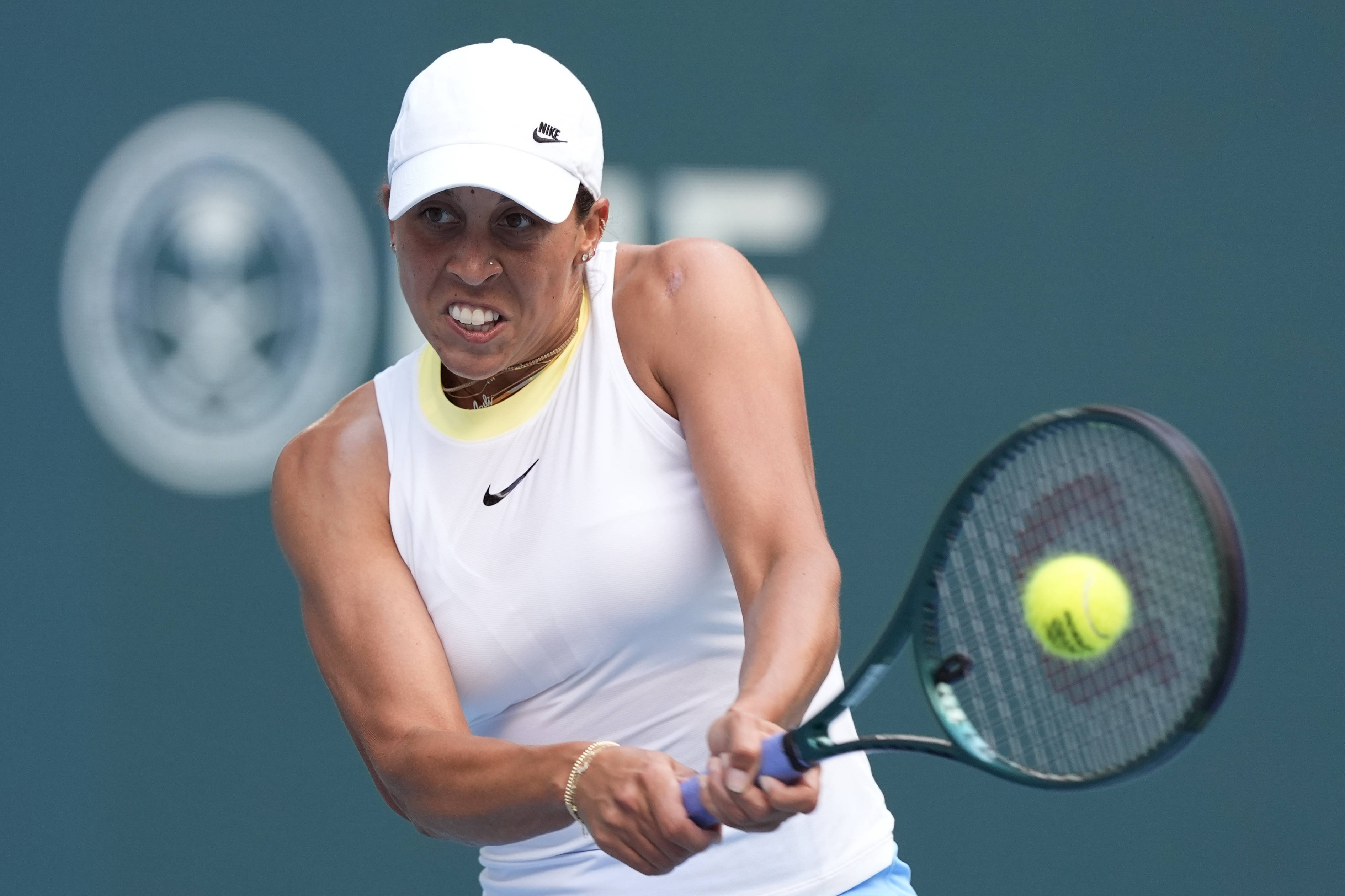 缓解内线轮 缓解内线轮